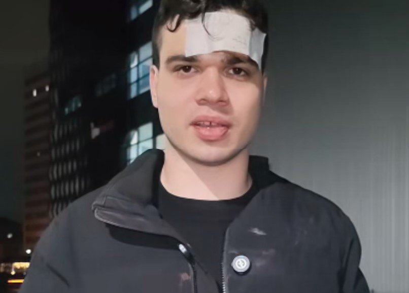 Пребитият Пело Кръстев: Имам 7 шева на главата, сектантите от "Величие" ми откраднаха телефона