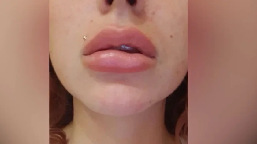 Свещеник: Изкуствената красота на момичетата води до депресия и смърт