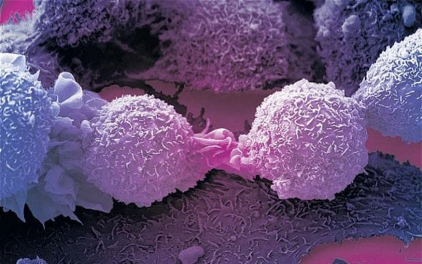 Британски учени случайно стигнаха до пробив в борбата с рака