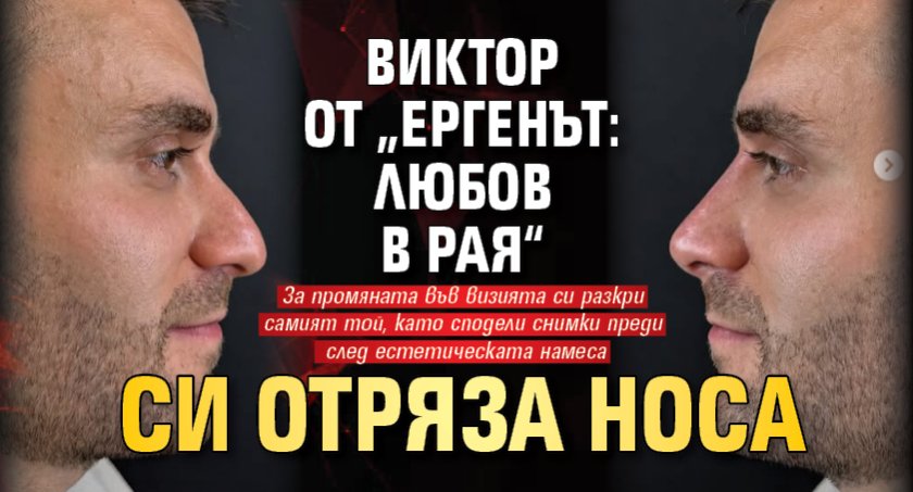 Виктор от &bdquo;Ергенът: Любов в рая&ldquo; си отряза носа