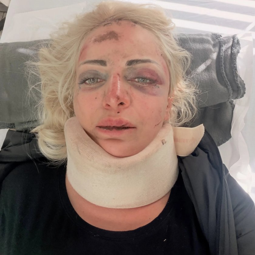 Гадже пребило Жанета Осипова (Снимка 18+)