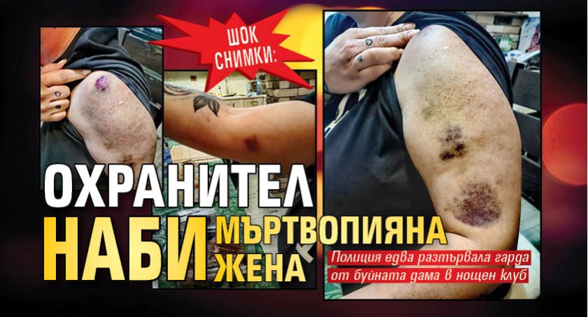 ШОК СНИМКИ: Охранител наби мъртвопияна жена