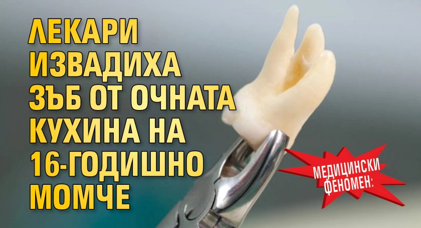Медицински феномен: Лекари извадиха зъб от очната кухина на 16-годишно момче