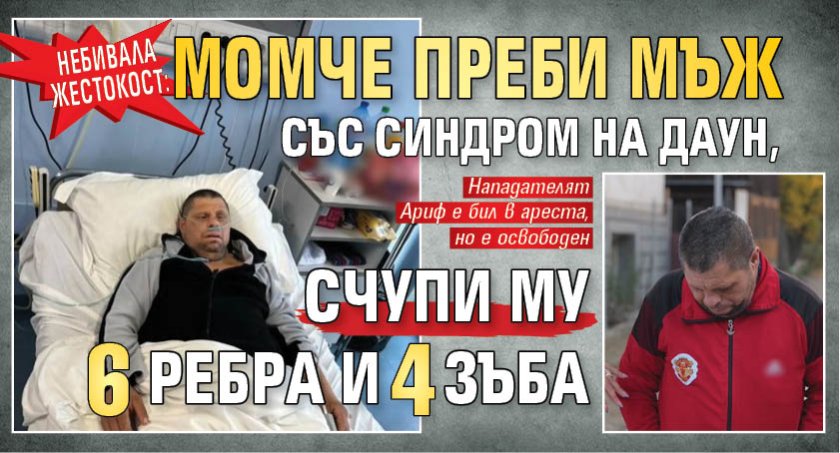 Небивала жестокост: Момче преби мъж със синдром на Даун, счупи му 6 ребра и 4 зъба