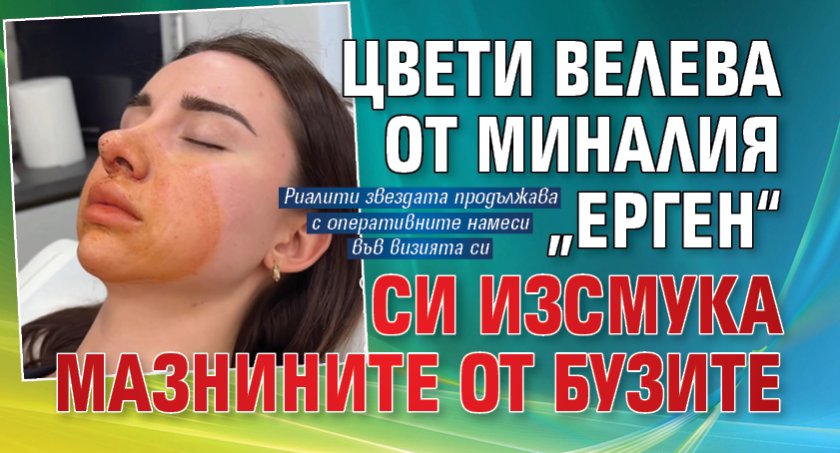 Цвети Велева от миналия &bdquo;Ерген&ldquo; си изсмука мазнините от бузите