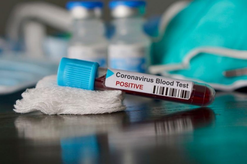 Все още няма коронавирус в България