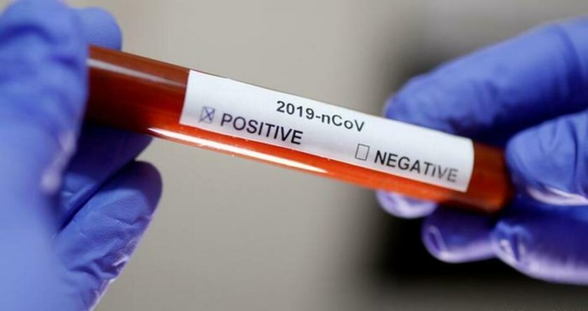 8 на сто от заразените с коронавирус в Италия са медици