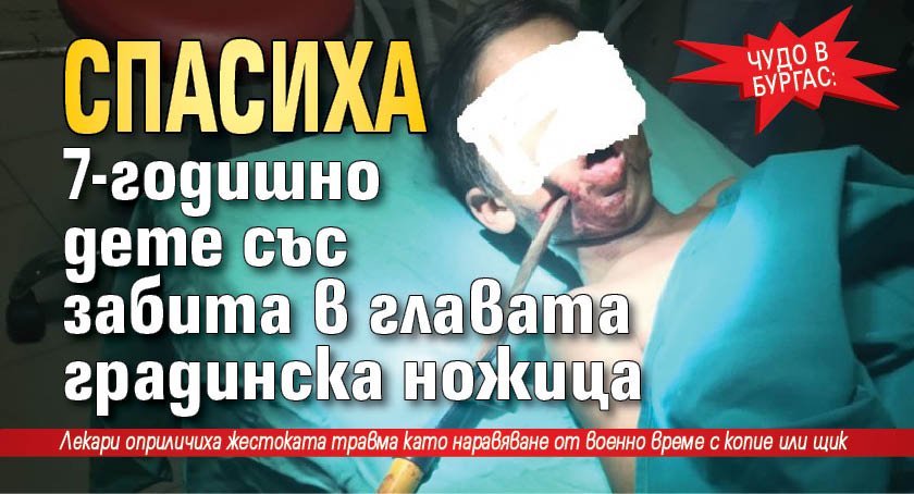Чудо в Бургас: Спасиха 7-годишно дете със забита в главата градинска ножица