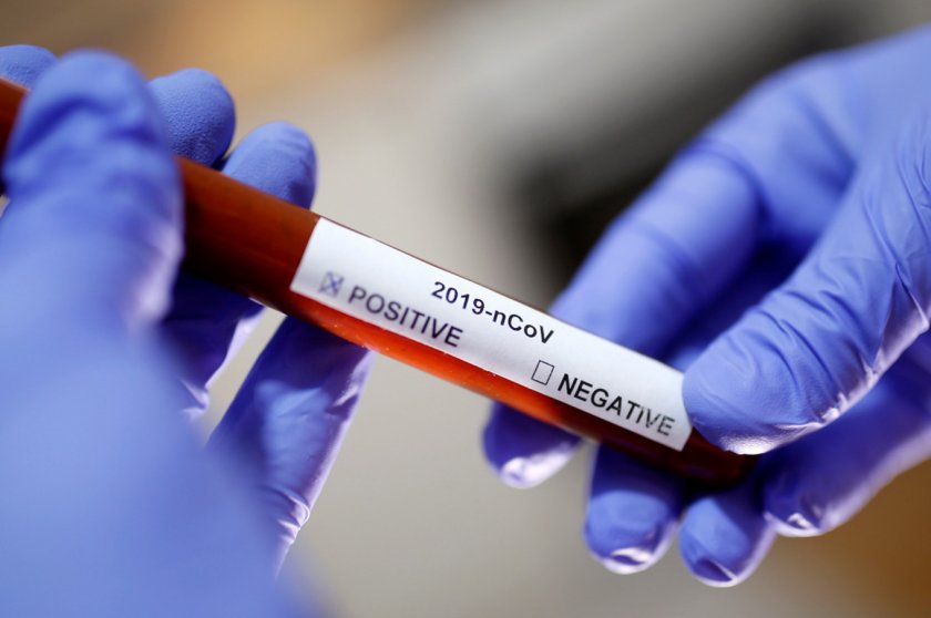 България е поръчала 1 милион теста за коронавирус