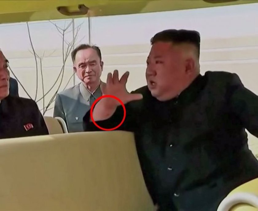 Мистериозна линия на ръката на Ким Чен Ун