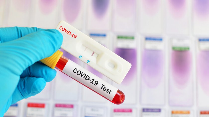 Бразилска клиника пусна първия генетичен тест за вируса