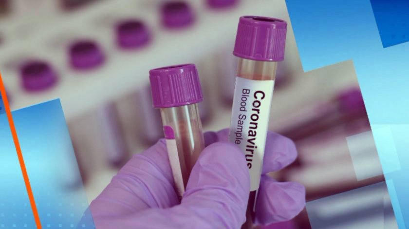 Нов тест за антитела при коронавирус дава данни за хода на заболяването