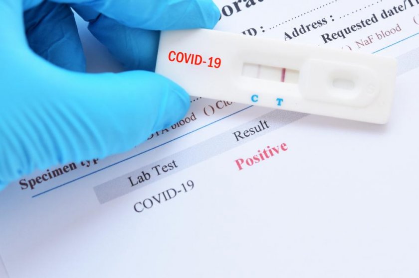 Още 9 жертви на коронавируса у нас, 270 са новите случаи
