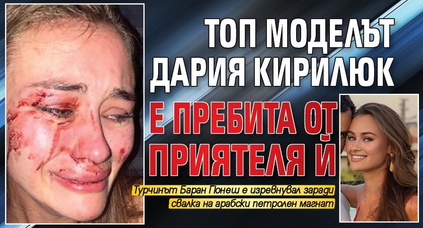 Топ моделът Дария Кирилюк е пребита от приятеля й 