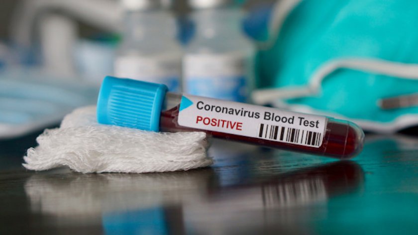 18 милиона регистрирани с коронавирус по света