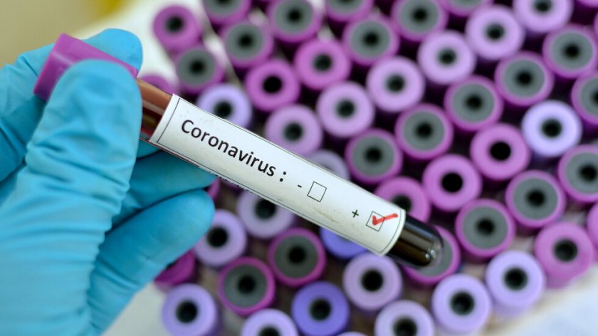 Нови трима с коронавирус в област Велико Търново 