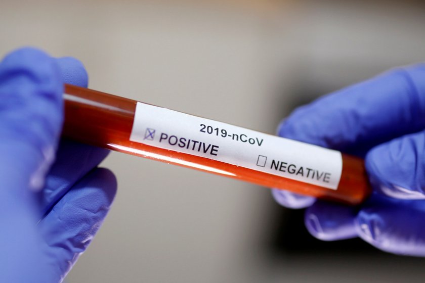 В Бразилия: PCR-тестовете станаха задължителни