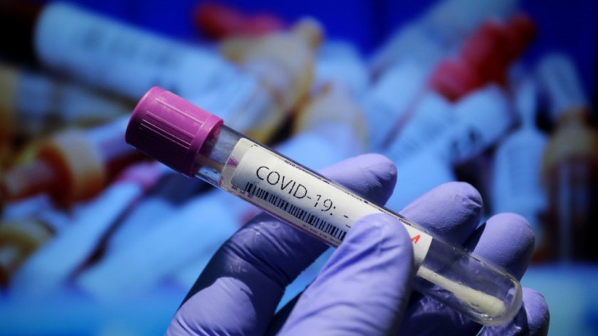158 нови заразени и 10 починали от Ковид-19 в България