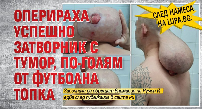 След намеса на Lupa.bg: Оперираха успешно затворник с тумор, по-голям от футболна топка