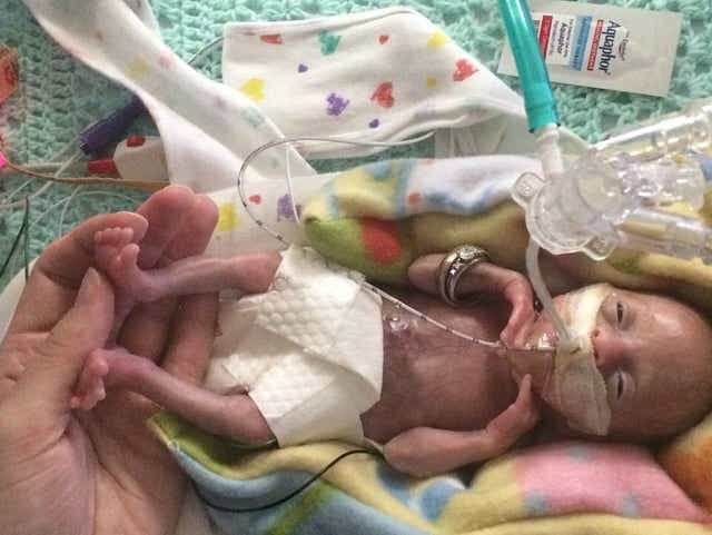 Чудо: Спасиха недоносено бебе след 6 часа в моргата