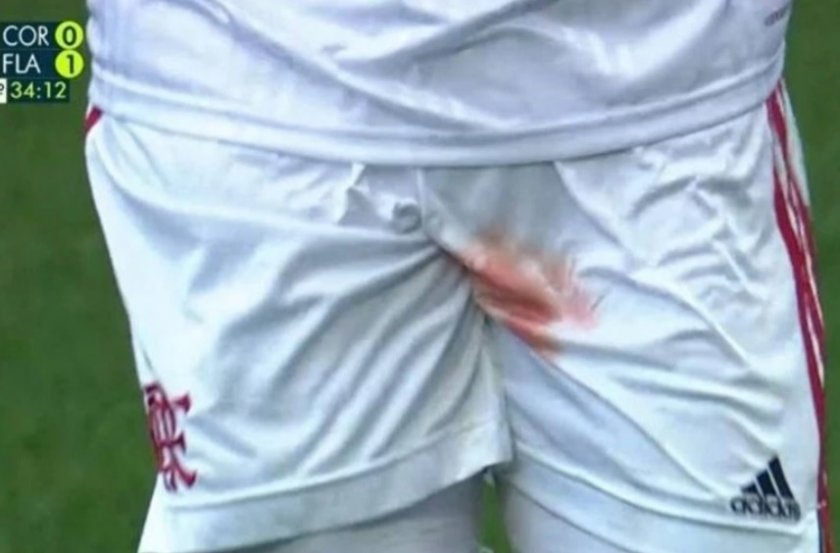 Футболист на Фламенго с прорезна рана на пениса (ВИДЕО) 