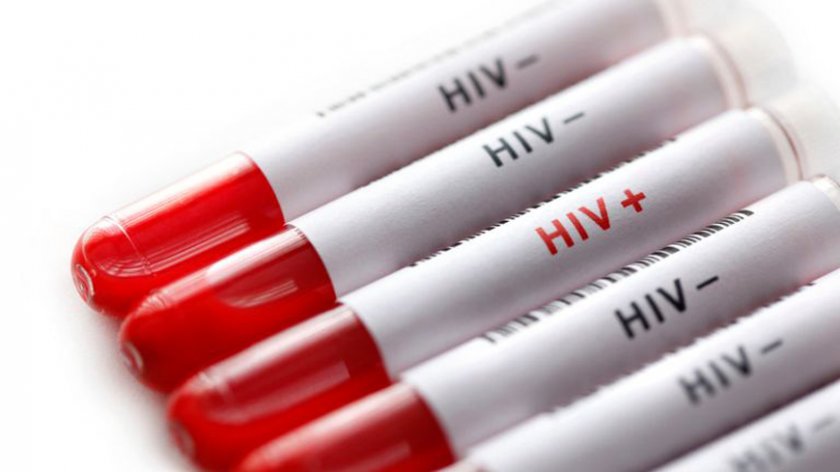 НПО-та предлагат законови промени за ефективна превенция срещу ХИВ
