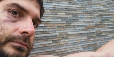 "Репортери без граници": Кога ще разследвате побоя над Димитър Кенаров?