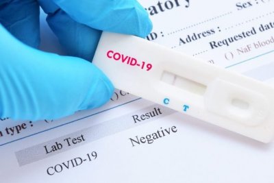 Аптеките в Австрия с гратис тестове за Covid 