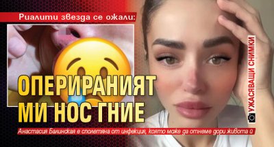 Риалити звезда се ожали: Оперираният ми нос гние (УЖАСЯВАЩИ СНИМКИ)