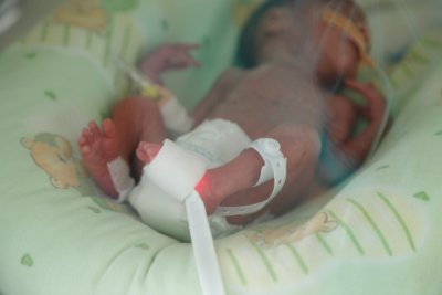 Бургаската болница получи специални пелени за недоносени бебета