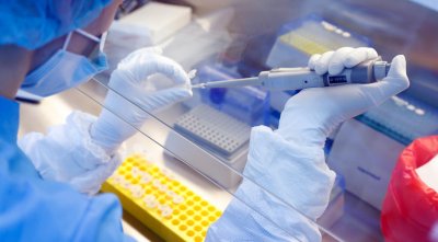 Заради тромбите: Ще изследват технологията на аденовирусните ваксини