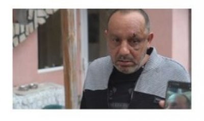 Пребиха и ограбиха мъж, защото карал бавно