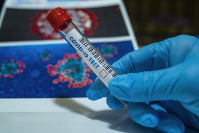 Хърватия разхлаби правилата за PCR-тестовете