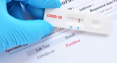 Четирима ученици от Елхово са с COVID-19 след лагер на Шкорпиловци