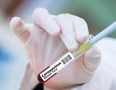 Учени: Възможна е комбинирана ваксина за грип и COVID-19