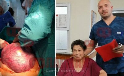 Изрязаха 13 кг тумор от Павлинка от Бургас (ВИДЕО)