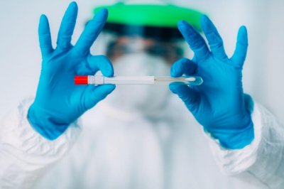 Защо ваксинирани умират от COVID-19?