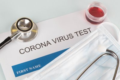В Румъния: Не приеха тестовете за антитела за зелен сертификат