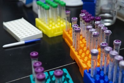 Откриха случайно епруветки с едра шарка в лаборатория в САЩ