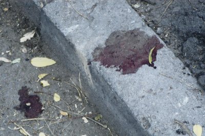 Див екшън край Пловдив: Кръв, юмруци и избити зъби заради момиче 