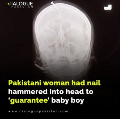Бременна пакистанка си заби пирон в главата за момче