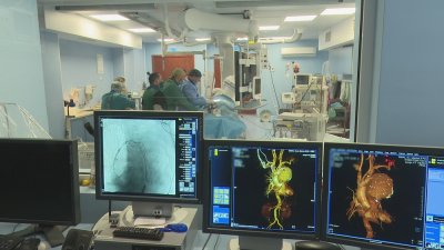 Уникално: Лекари от Варна спасиха жена с разкъсана аорта