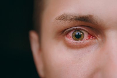 Паренето на очите е симптом на ужасна болест