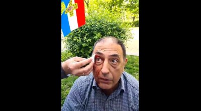 Лидерът на Възраждане Костадин Костадинов публикува видео с окървавен мъж