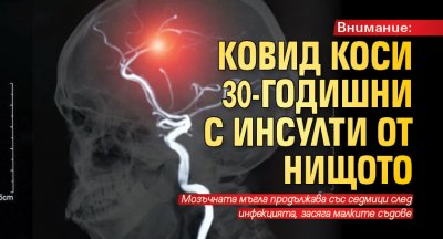 Внимание: Ковид коси 30-годишни с инсулти от нищото 