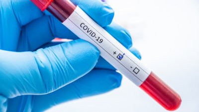 313 нови случая на коронавирус са били регистрирани през последното