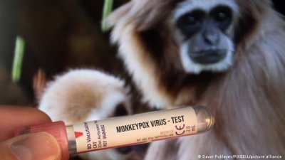 Симптомите на маймунска шарка са треска характерен обрив и подути