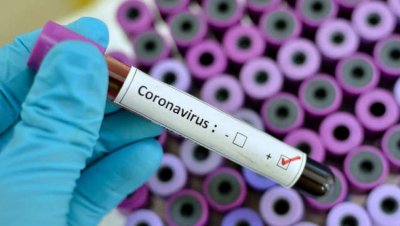 Осемдесет са новите случаи на коронавирус у нас за последните