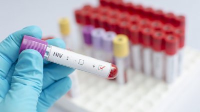 Неваксинирани и с ХИВ - до четири пъти по-застрашени от дълъг COVID-19