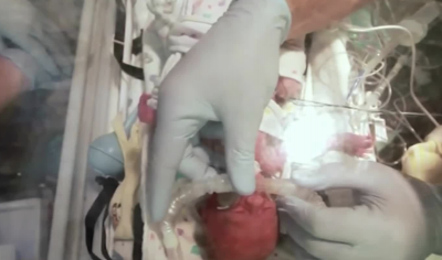 Чудо! Български лекари поставиха стент на новородения Виктор